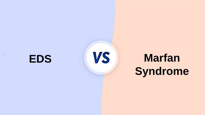 EDS vs Marfan Syndrome