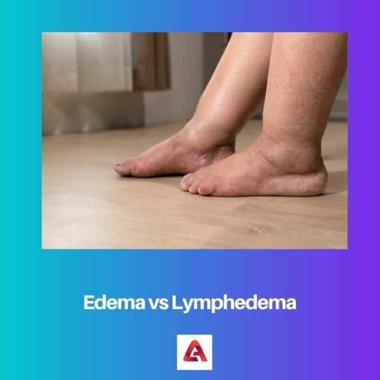 Edema vs Lymphedema: Difference and Comparison