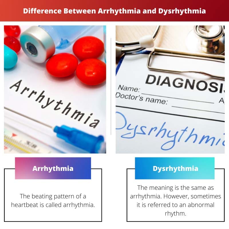Différence entre l'arythmie et la dysrythmie