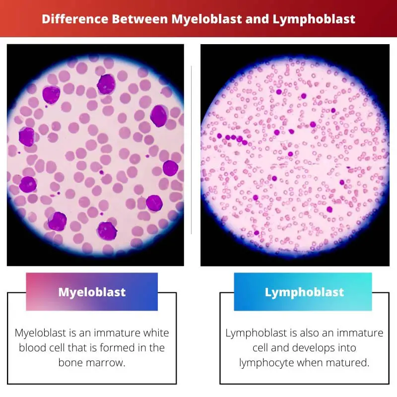 Difference Between Myeloblast and Lymphoblast