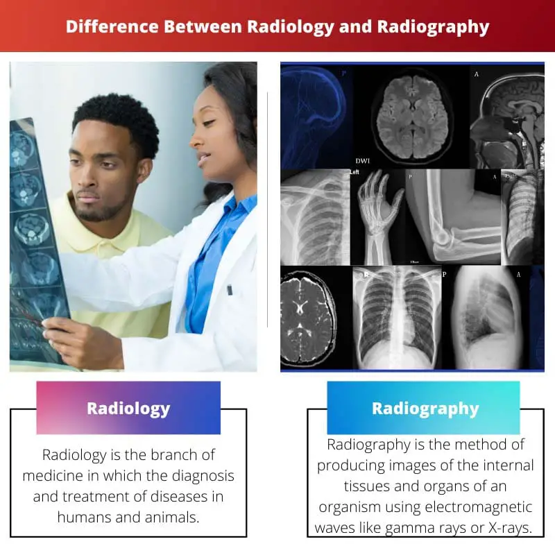 Diferencia entre radiología y radiografía.