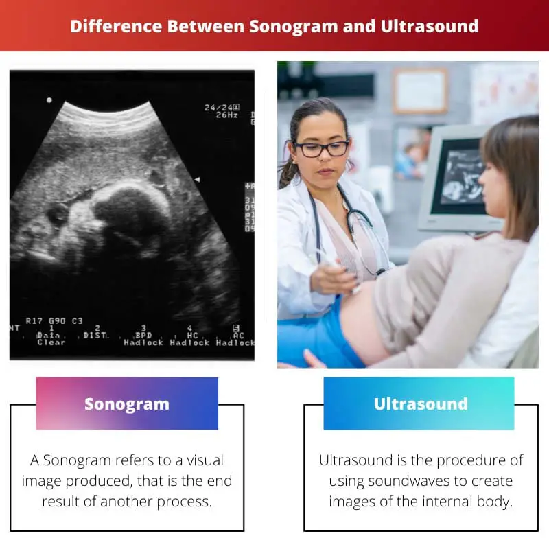 Difference Between Sonogram and Ultrasound