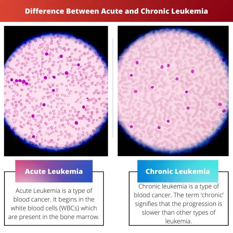 Diferencia entre leucemia aguda y crónica