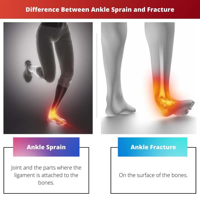 Difference Between Ankle Sprain and Fracture