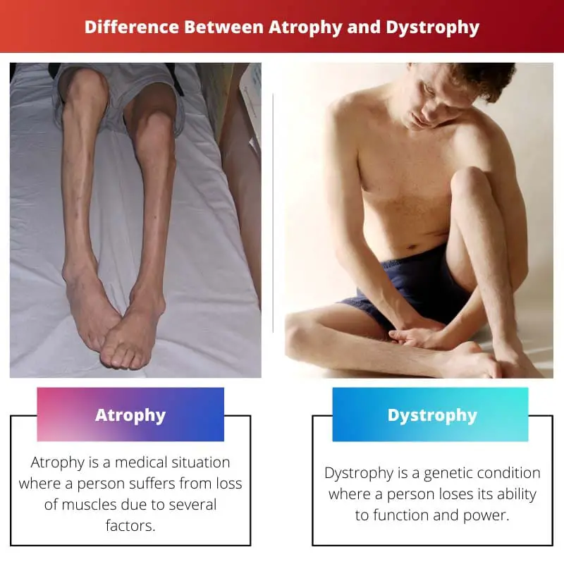 Difference Between Atrophy and Dystrophy