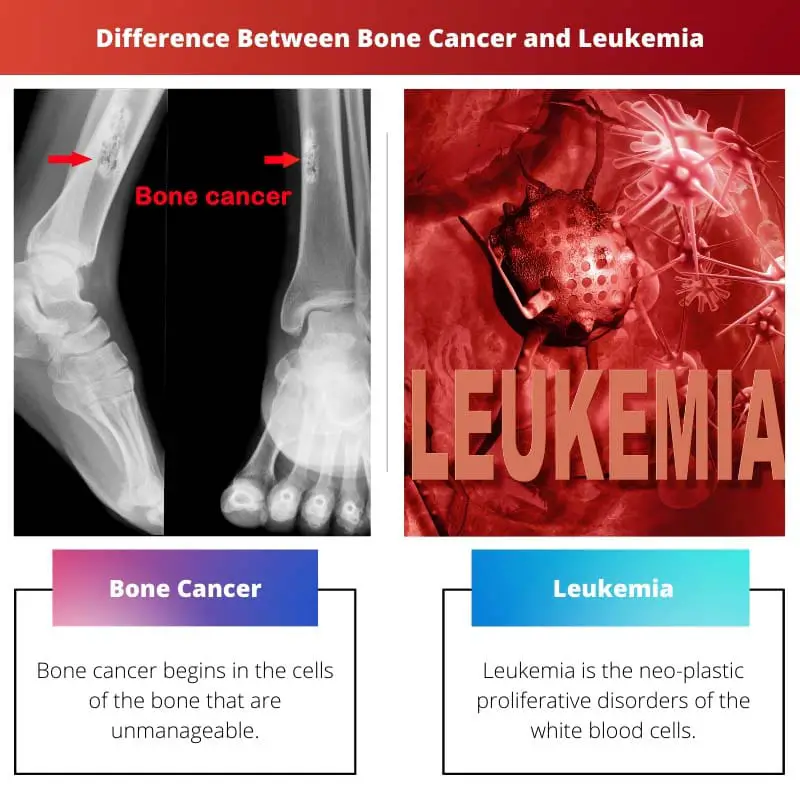 Difference Between Bone Cancer and Leukemia