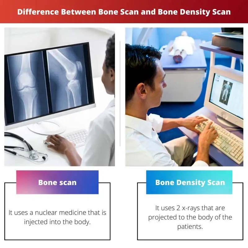 Difference Between Bone Scan and Bone Density Scan