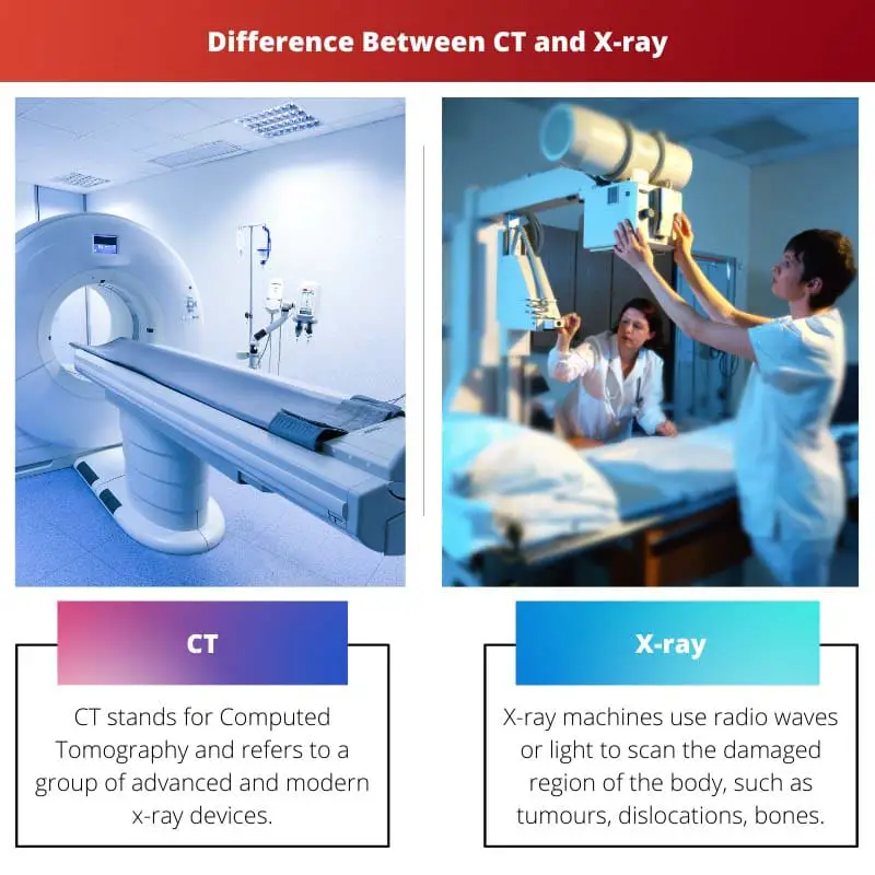 Diferencia entre CT y rayos X