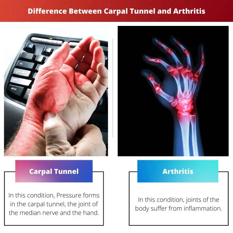 Rozdíl mezi karpálním tunelem a artritidou
