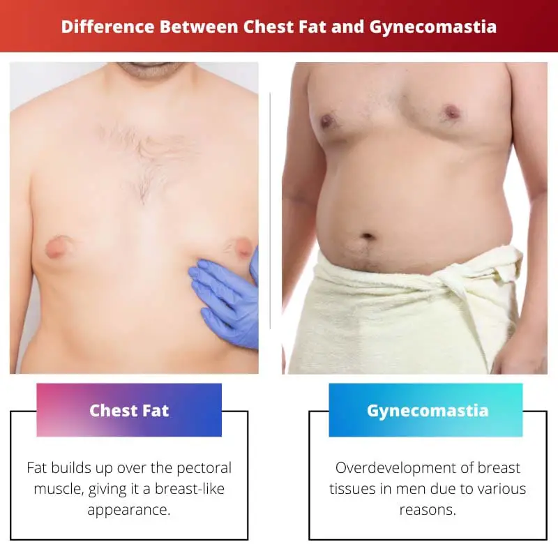Difference Between Chest Fat and Gynecomastia
