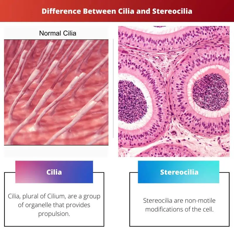ความแตกต่างระหว่าง Cilia และ Stereocilia