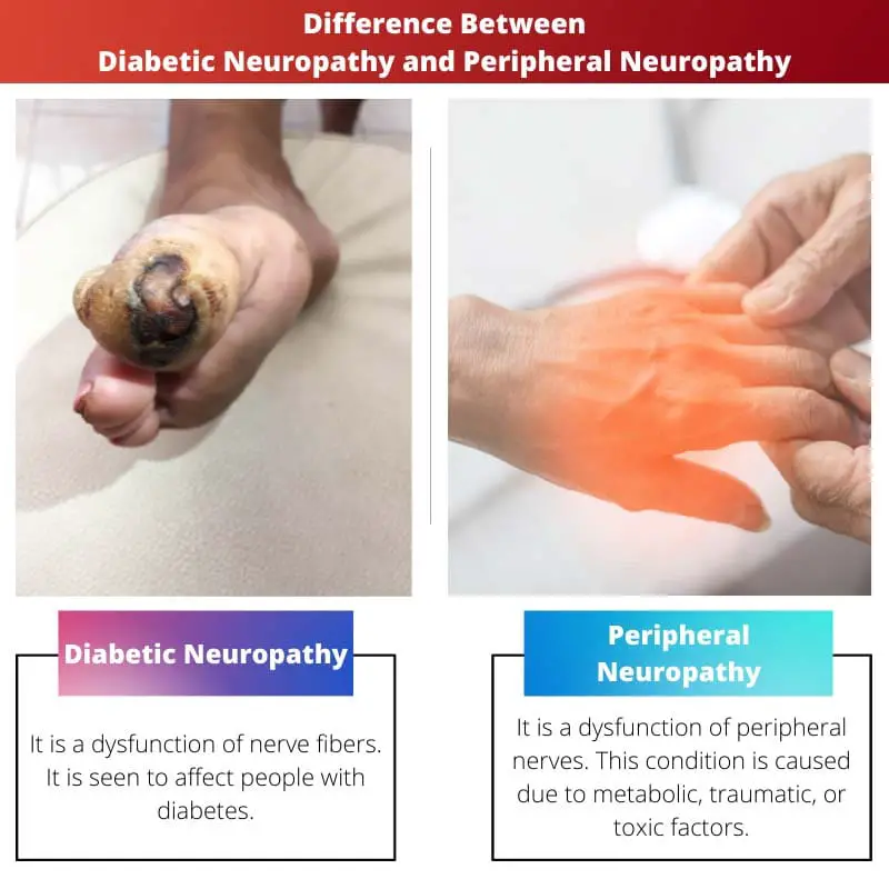 Diferença entre neuropatia diabética e neuropatia periférica