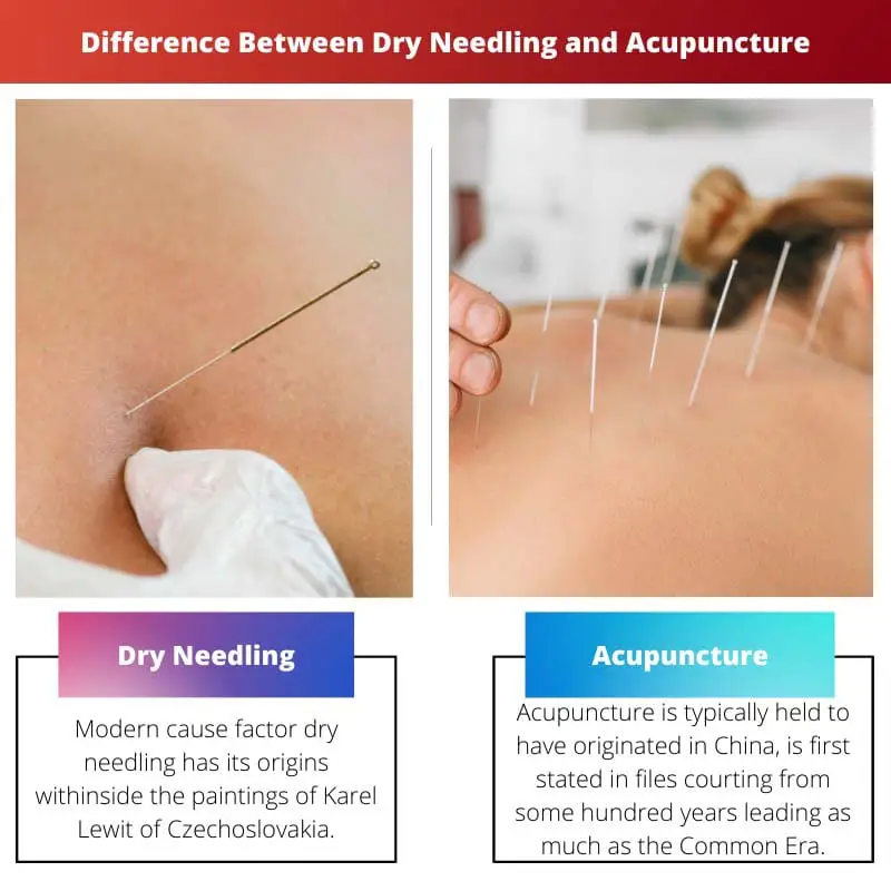 Rozdíl mezi suchým vpichováním a akupunkturou