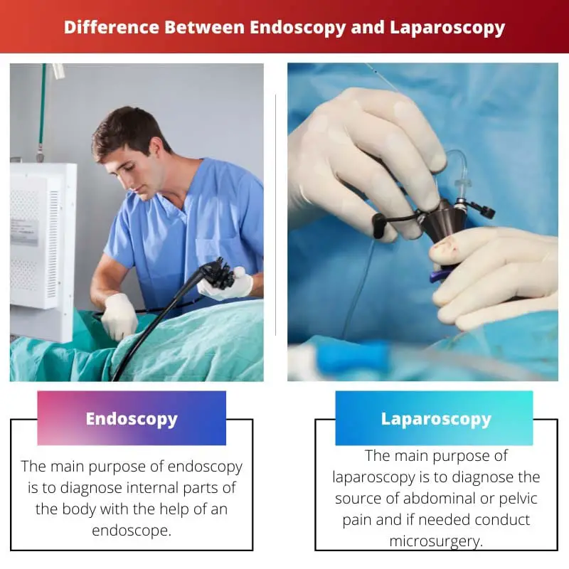 Différence entre l'endoscopie et la laparoscopie