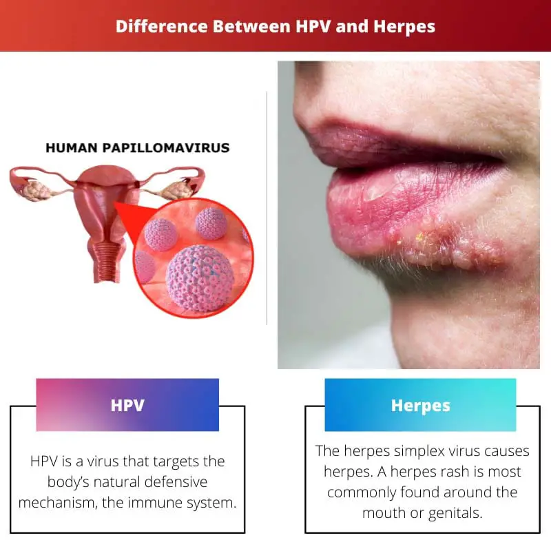 Diferencia entre el VPH y el herpes
