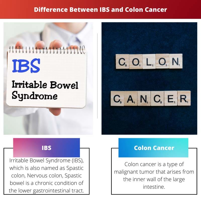 IBS 和结肠癌之间的区别