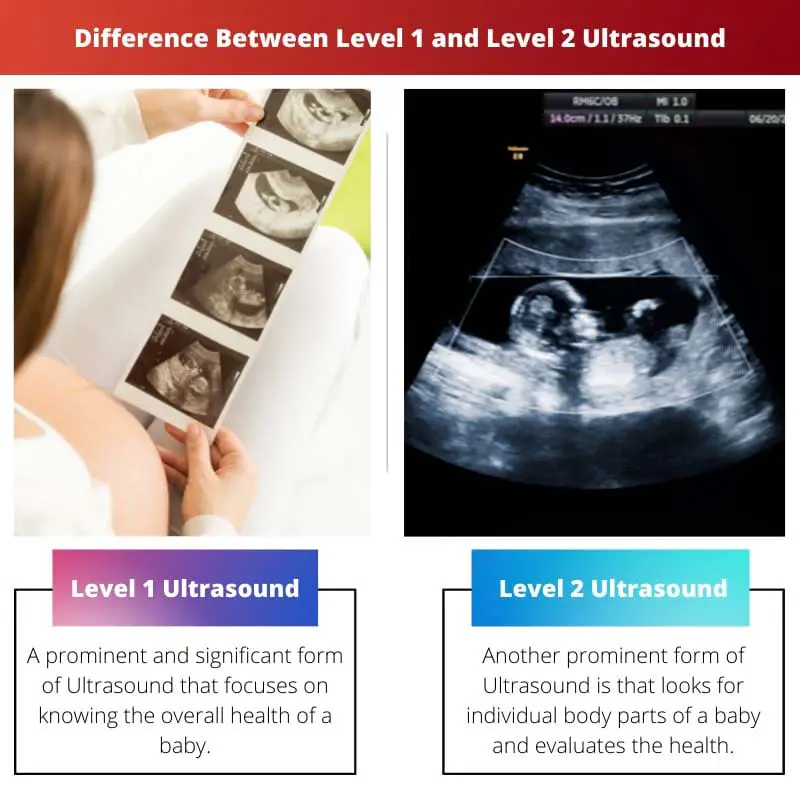 Diferencia entre ultrasonido de nivel 1 y nivel 2