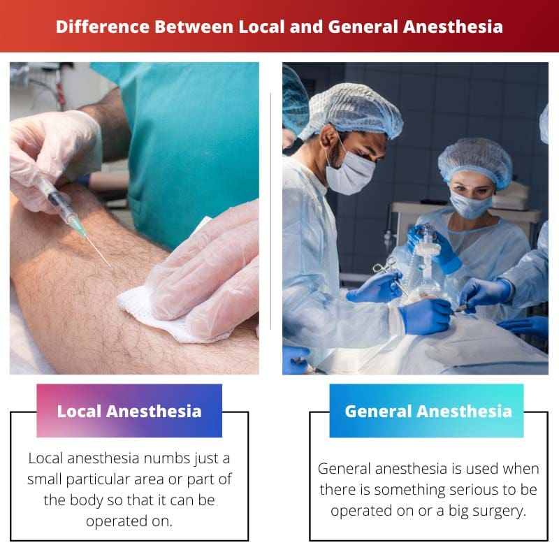Diferencia entre anestesia local y general