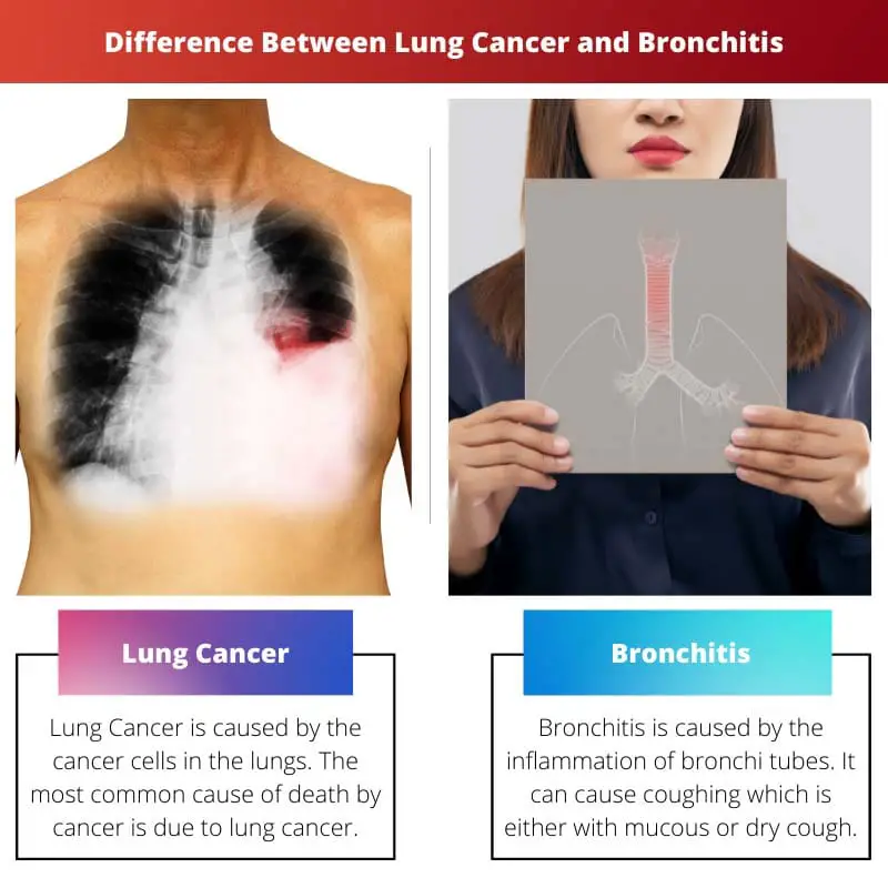 Різниця між раком легенів і бронхітом