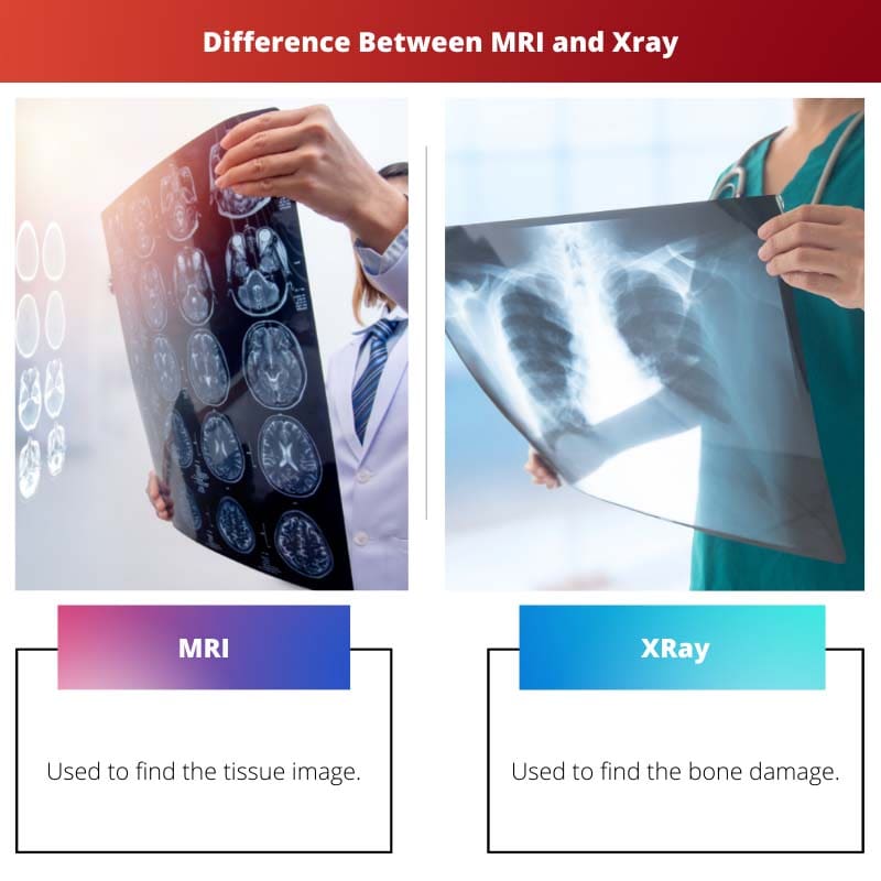 Différence entre l'IRM et la radiographie