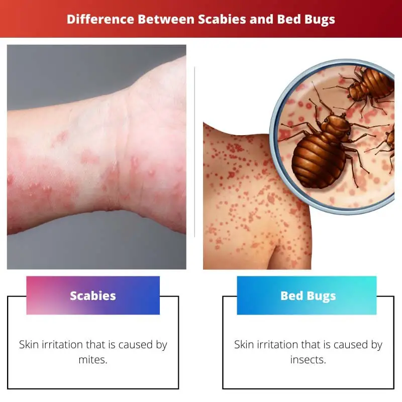 Difference Between Scabies and Bed Bugs