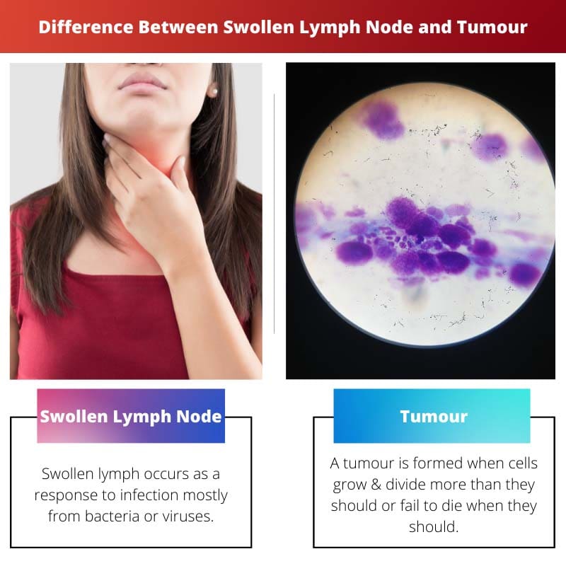 Diferencia entre ganglio linfático inflamado y tumor