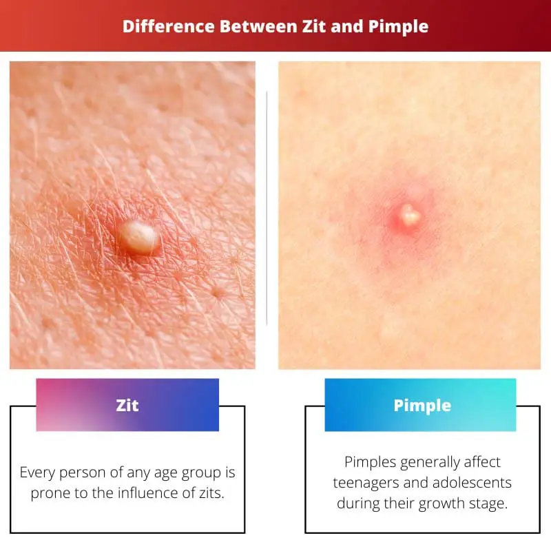 Différence entre Zit et Pimple