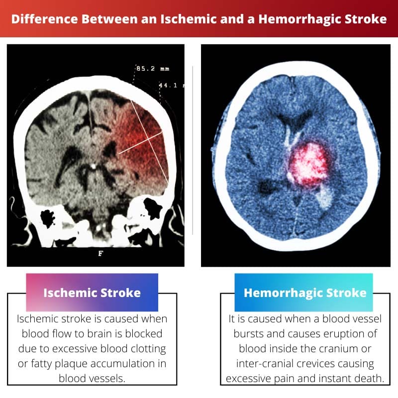 What Is Hemorrhagic Conversion Of Stroke