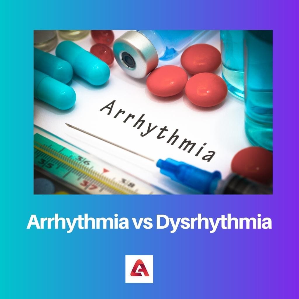 Arrhythmia vs Dysrhythmia