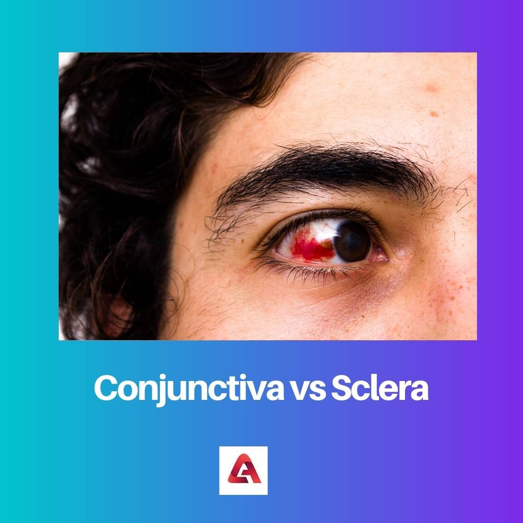 Conjunctiva vs Sclera
