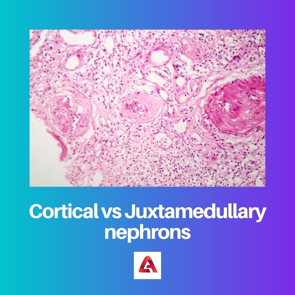 Kortikaalsed vs juxtamedullaarsed nefronid