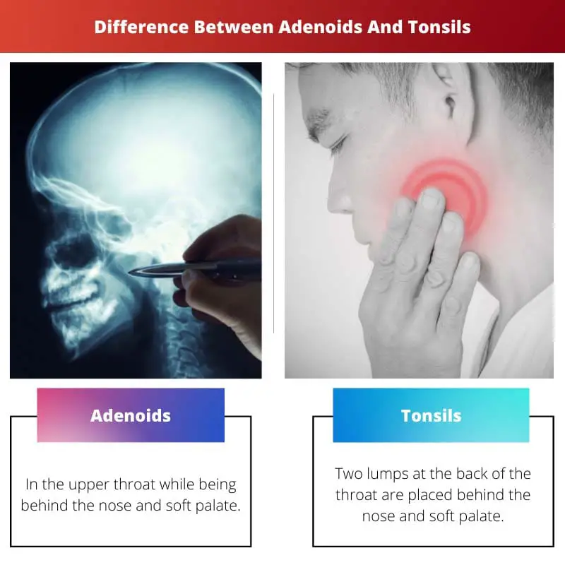 Difference Between Adenoids And Tonsils