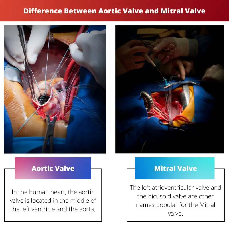 Diferencia entre la válvula aórtica y la válvula mitral