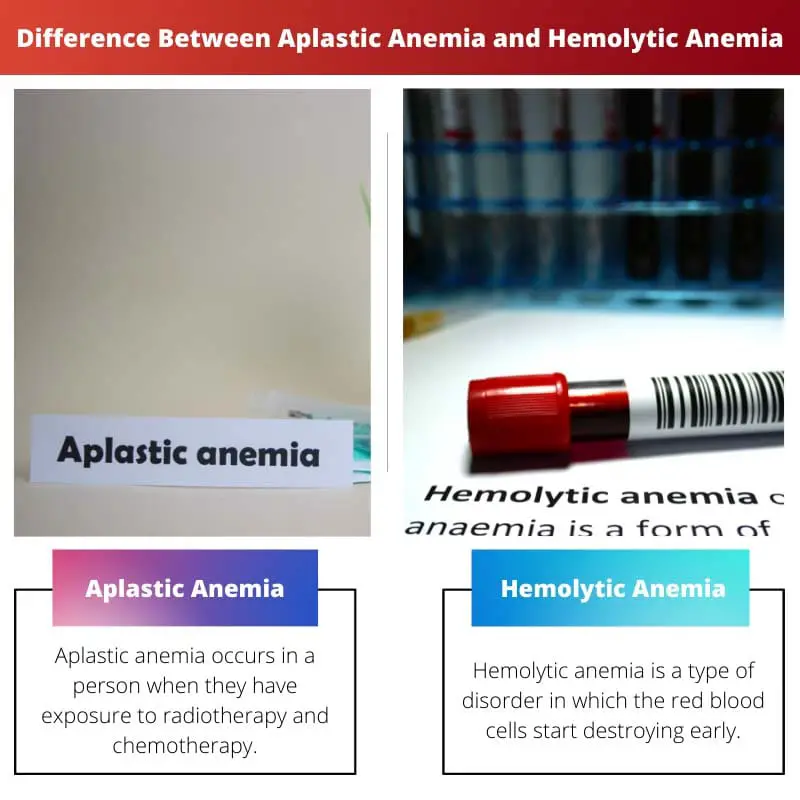 Razlika između aplastične i hemolitičke anemije