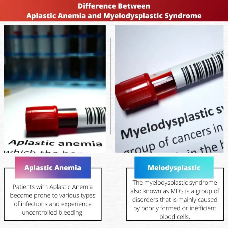 Difference Between Aplastic Anemia and Myelodysplastic Syndrome