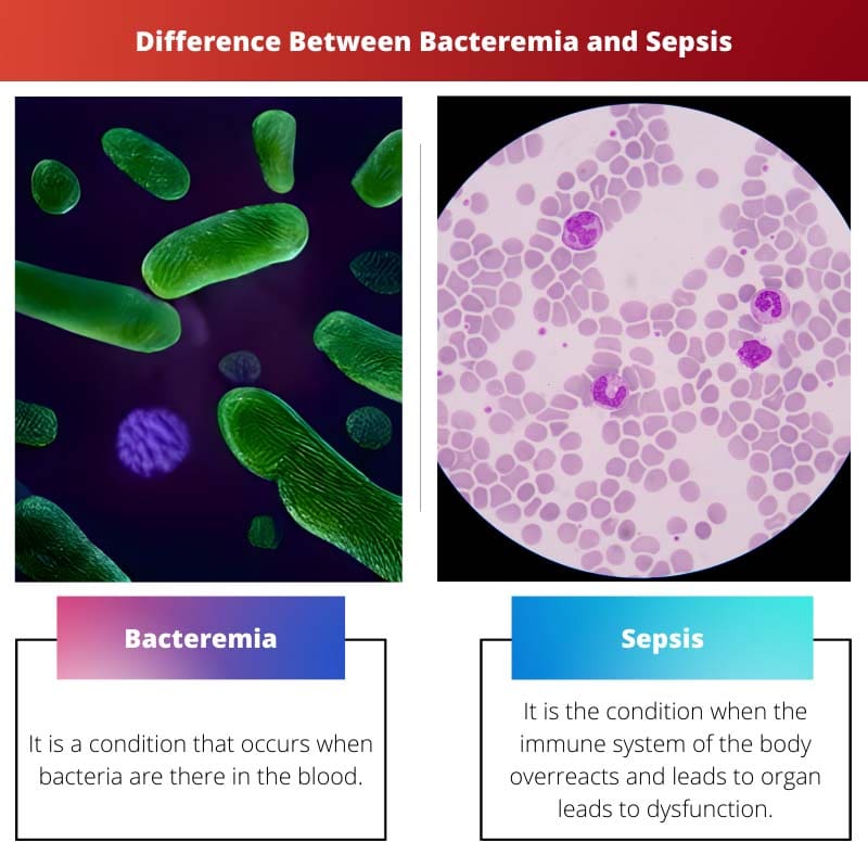 Unterschied zwischen Bakteriämie und Sepsis