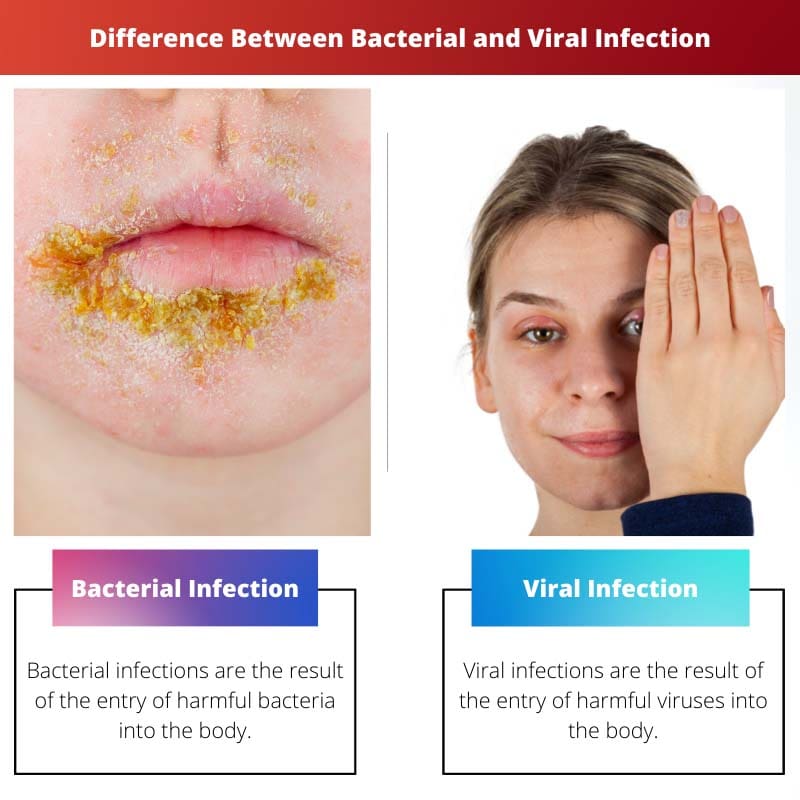 الفرق بين العدوى البكتيرية والفيروسية