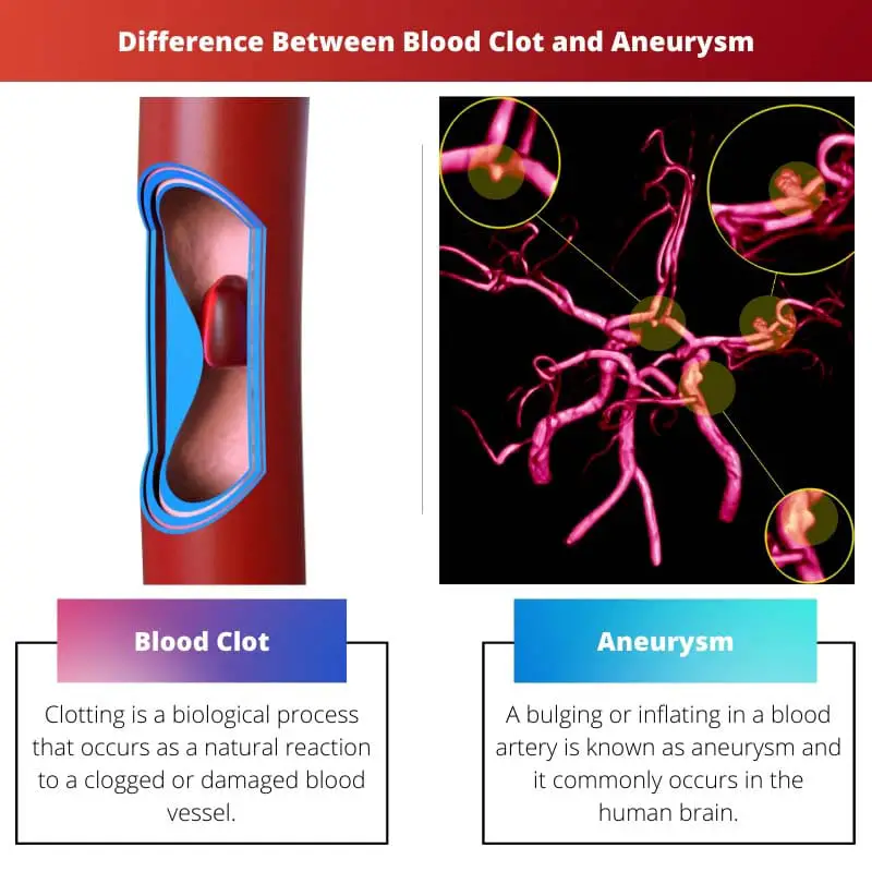 Verschil tussen bloedstolsel en aneurysma