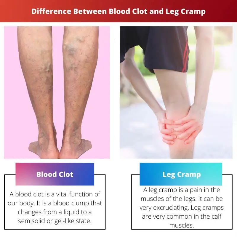 Difference Between Blood Clot and Leg Cramp