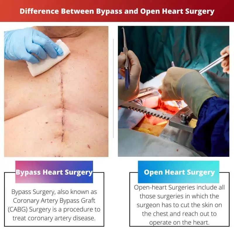 Разница между шунтированием и операцией на открытом сердце