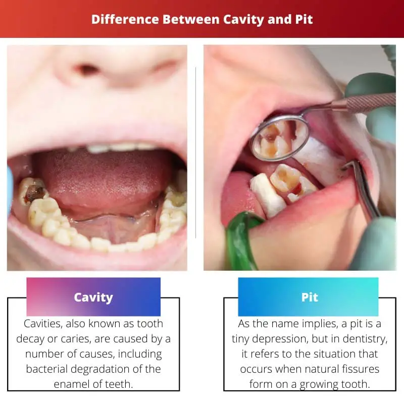 Difference Between Cavity and Pit