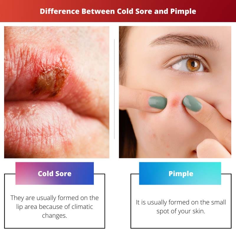 唇疱疹和丘疹的区别