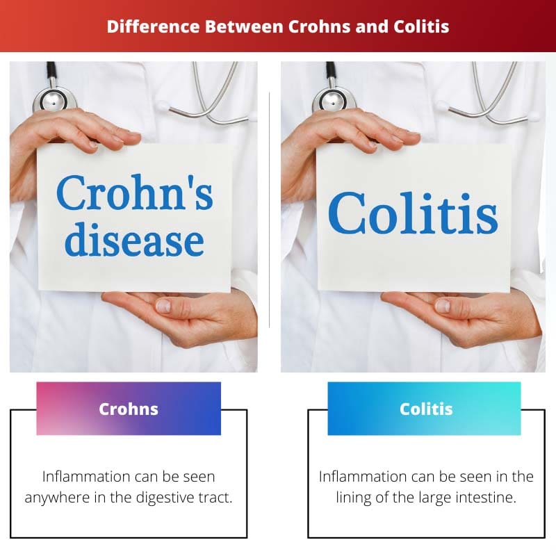 Verschil tussen Crohn en colitis