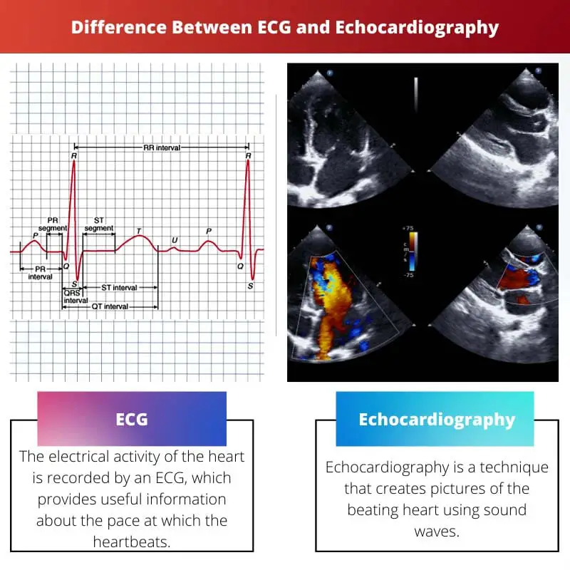 Difference Between ECG and Echocardiography