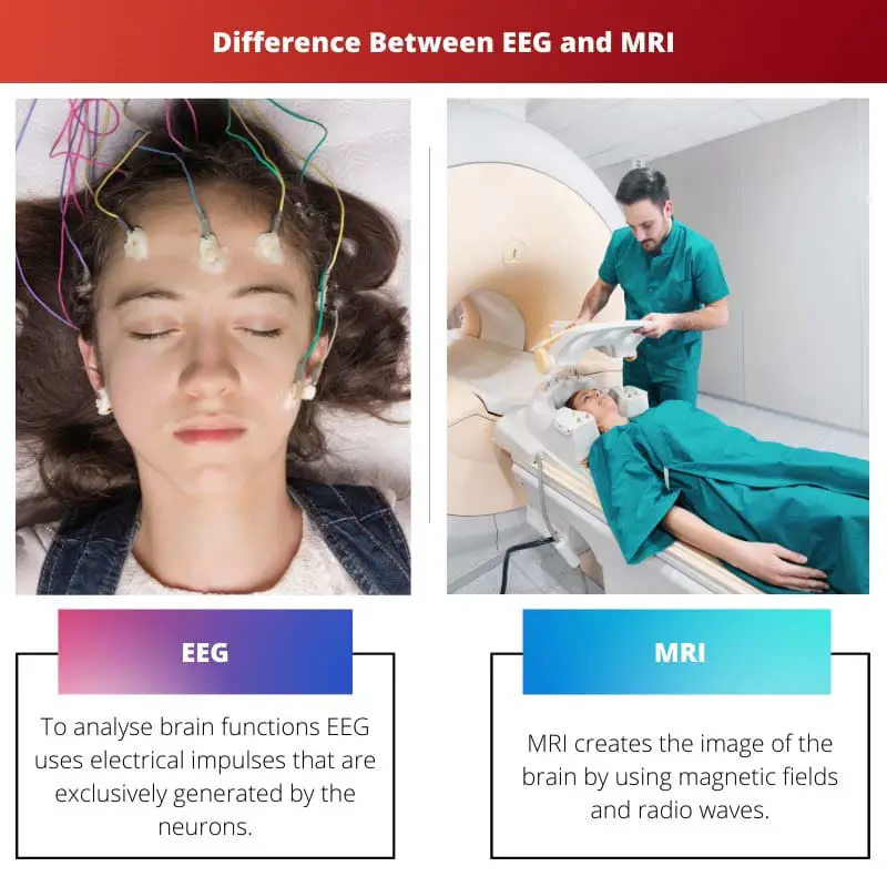 Atšķirība starp EEG un MRI