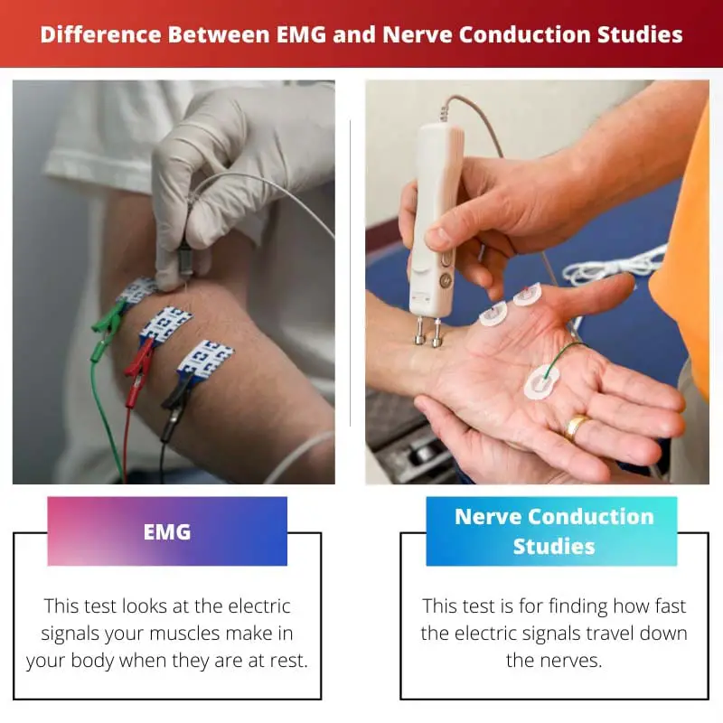 Διαφορά μεταξύ EMG και μελετών αγωγιμότητας νεύρων