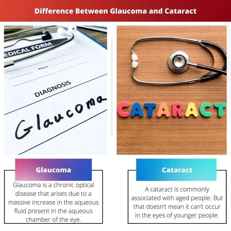 Diferencia entre glaucoma y catarata
