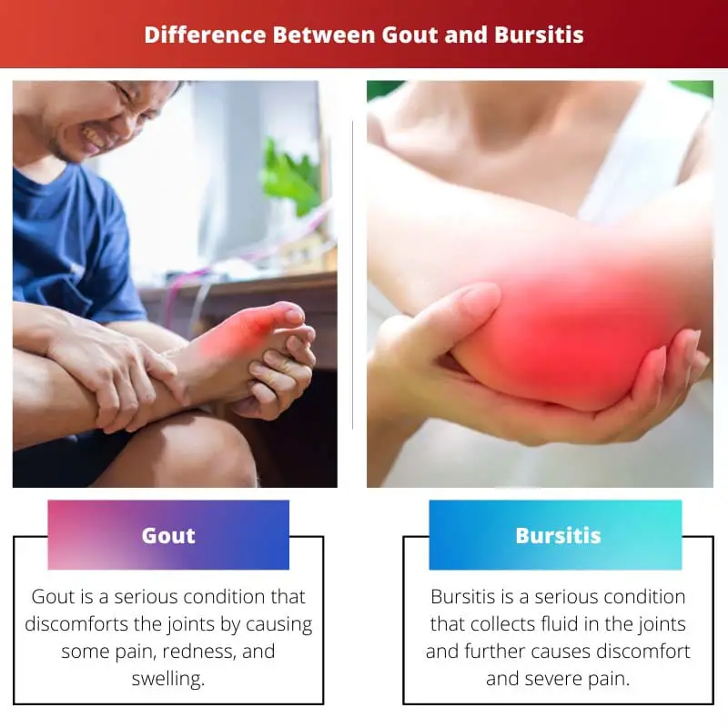 Difference Between Gout and Bursitis