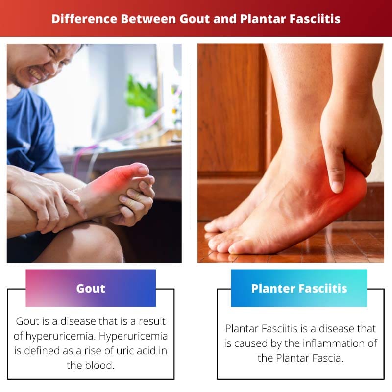 Difference Between Gout and Plantar Fasciitis