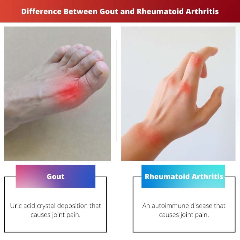 Rozdíl mezi dnou a revmatoidní artritidou